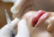 Harmonização facial feita por dentistas em centro de polêmica e na mira da Justiça
