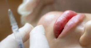 Harmonização facial feita por dentistas em centro de polêmica e na mira da Justiça